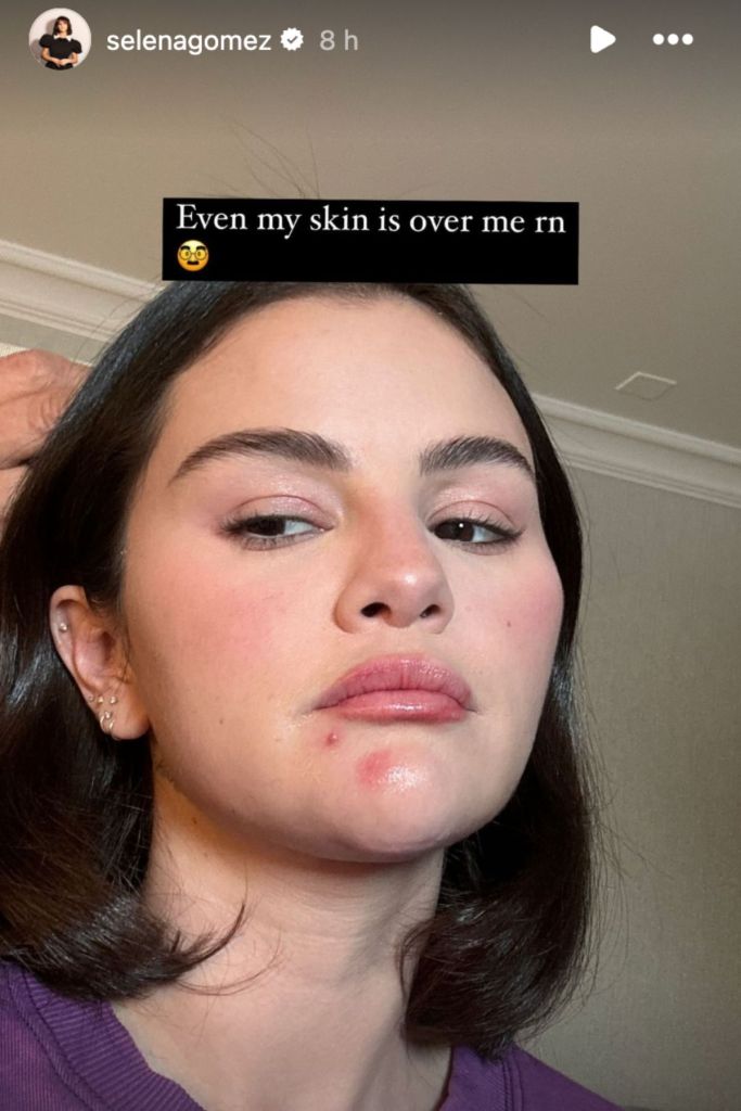Selena Gomez skin
