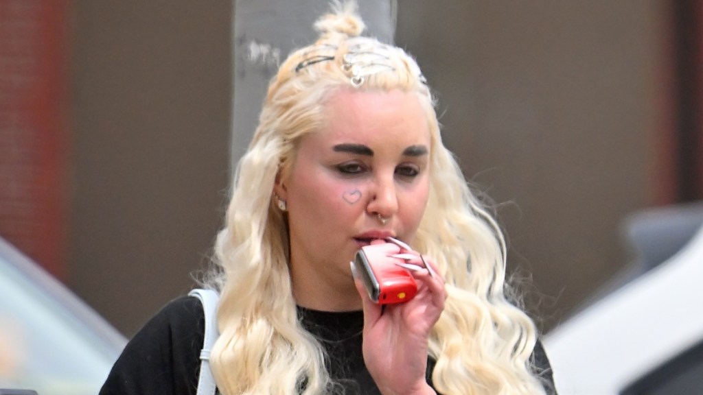 Amanda Bynes Before & After: What Happened to Her Face?