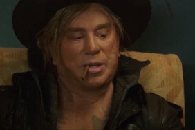 what happened to mickey rourke face before after surgery