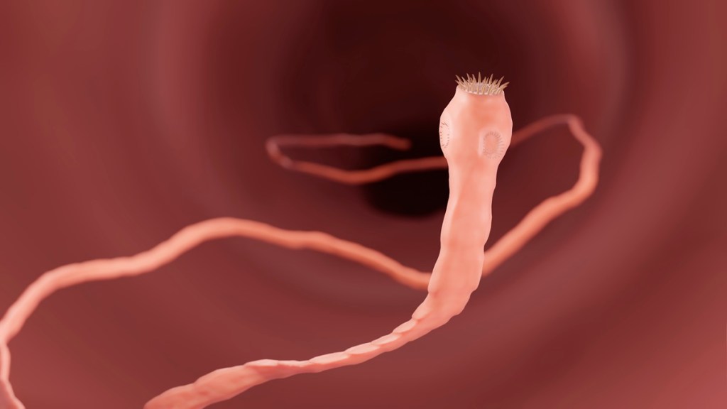 Human Case of Flesh-Eating Parasites Reported in US