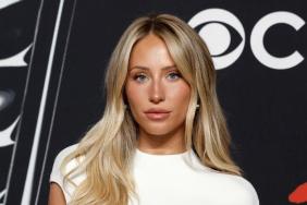 Alix Earle Shows Off Her DWTS Bruises: 'I Don’t Think I Can Walk'