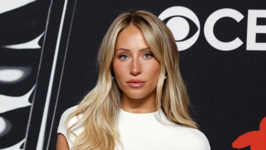 Alix Earle Shows Off Her DWTS Bruises: 'I Don’t Think I Can Walk'