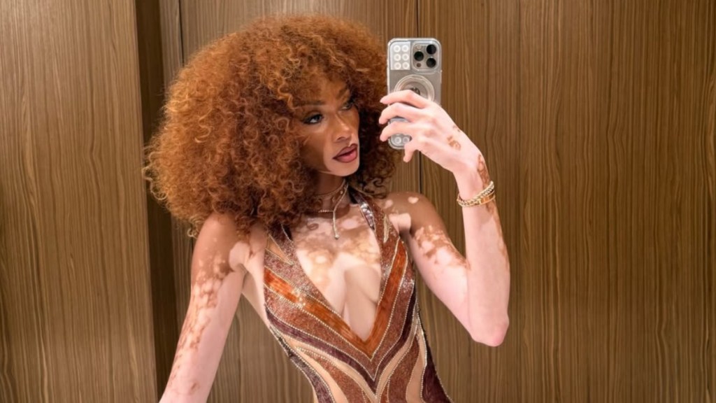 Winnie Harlow Has Fans ‘Obsessed’ With Her in Brown Daring Maxi Dress