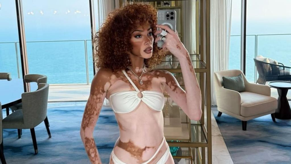 Winnie Harlow in Tiny White Two-Piece Has Fans Saying ‘Body Is the Finest of Teas'
