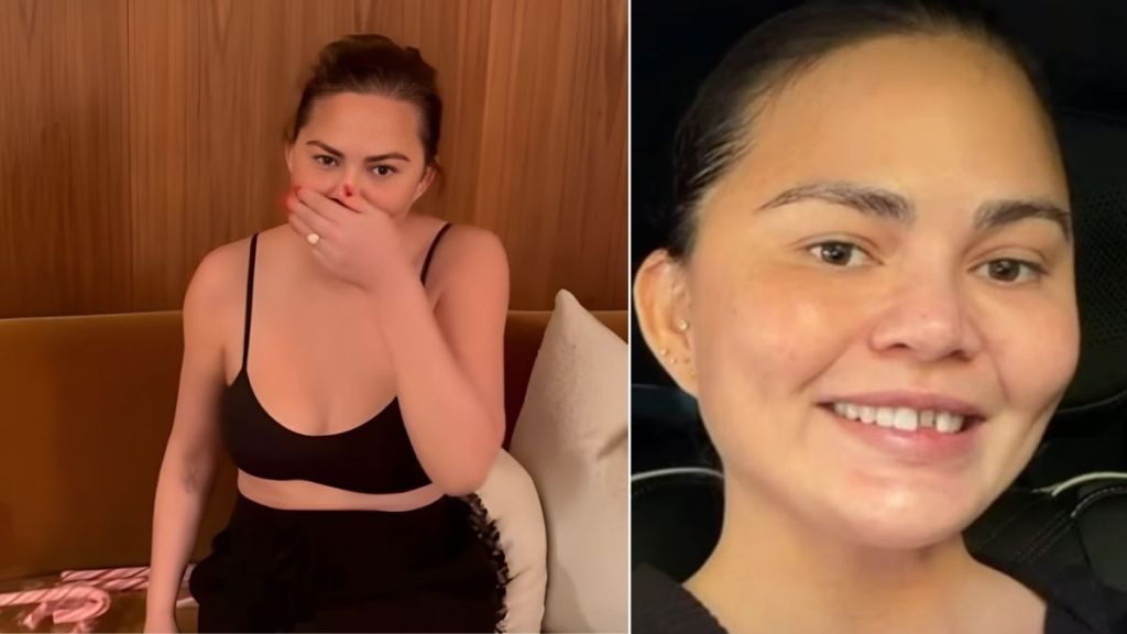 Chrissy Teigen Gives Closer Look at Christmas Gone Wrong