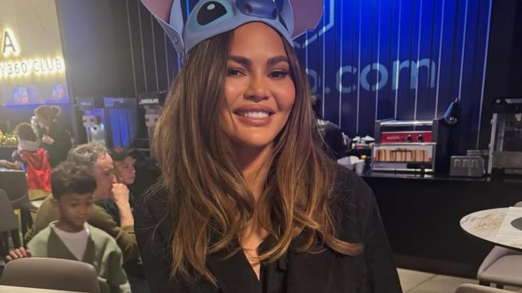 Chrissy Teigen Gets Tooth Fixed After Candy Cane Incident