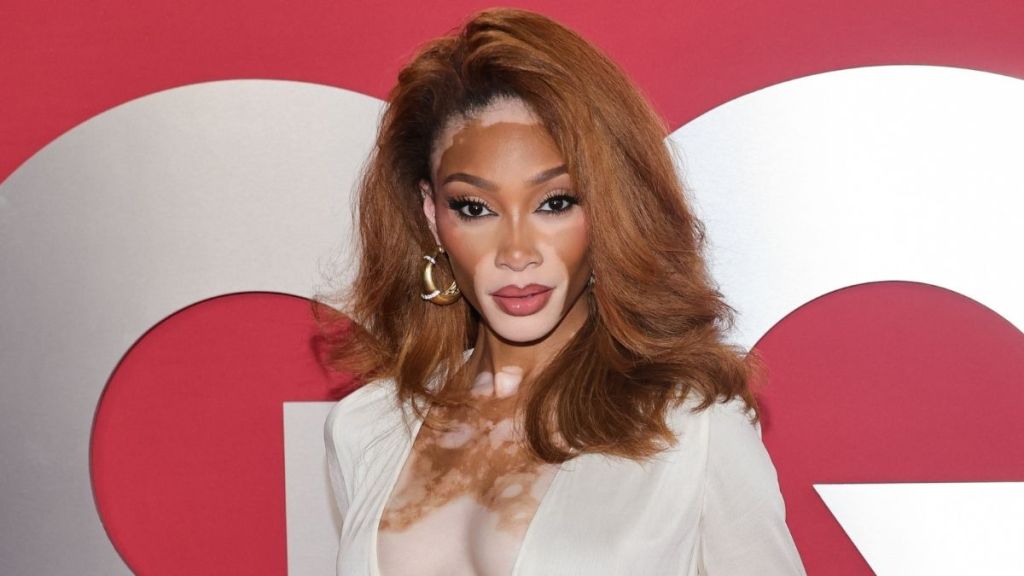 Winnie Harlow Rocks Sparkly Bikini Set & Completely Sheer Pants