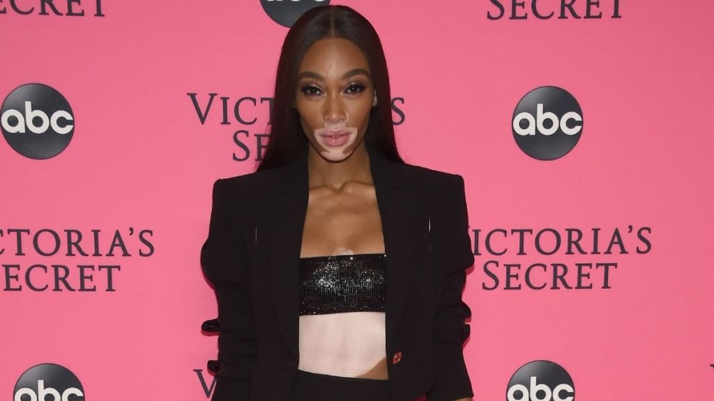 Winnie Harlow